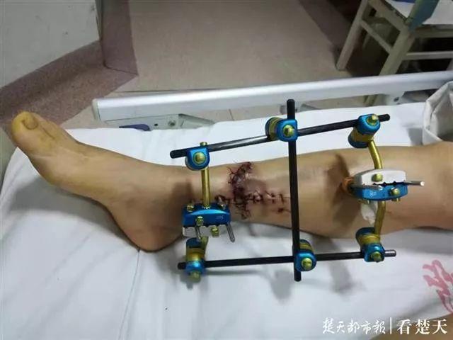 又出事了！女子在这种“网红桥”上被甩出，结果…