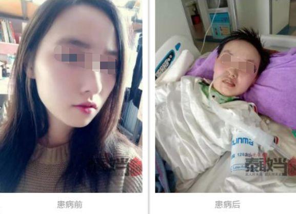 被蚊子咬一口，21岁女孩已躺重症监护室快一年!