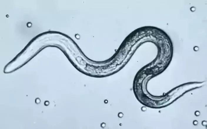 2岁女孩突然失明、视网膜脱离，眼睛里长虫！起因是家里的…"
