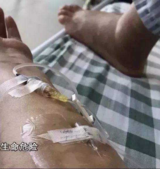 可怕！东莞一小区惊现多种毒蛇，多人被咬中毒！