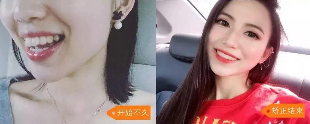 高达5w！在东莞，人人可领这份补贴，不限户籍！