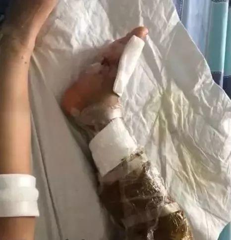 可怕！东莞一小区惊现多种毒蛇，多人被咬中毒！