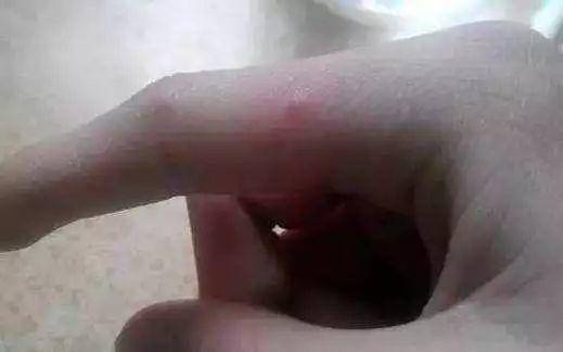 突发！2个孩子被感染！东莞这个传染病进入高发期！严重会致死！