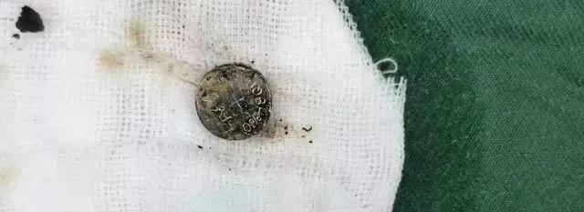 东莞两岁孩子发烧呕吐不止，只因喝了爸爸煮的粥！医生一看很严重……