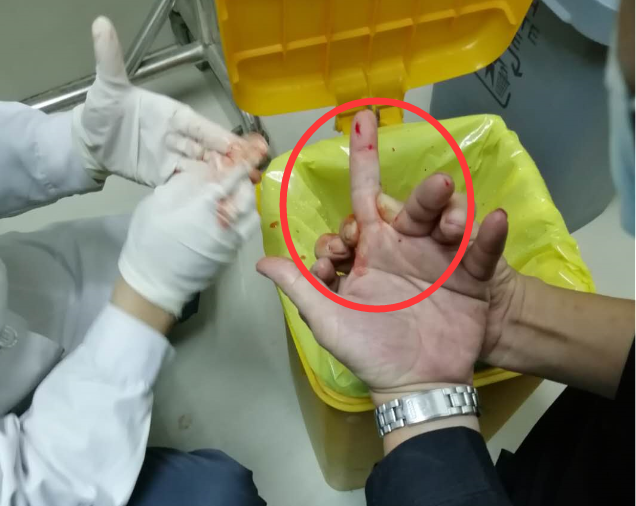 揪心！塘厦一小孩命悬一线...