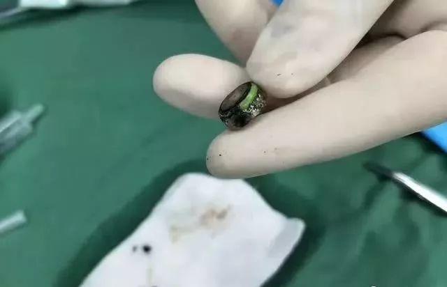 东莞两岁孩子发烧呕吐不止，只因喝了爸爸煮的粥！医生一看很严重……