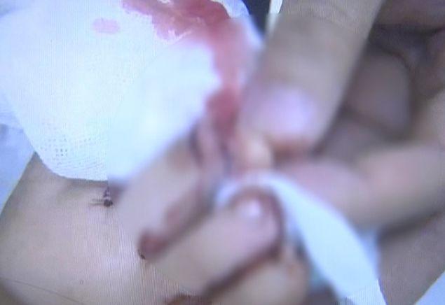 麦当劳里一个动作，东莞4岁女童惨遭截趾，还有孩子因它身亡！家长注意