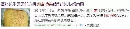 突发！2个孩子被感染！东莞这个传染病进入高发期！严重会致死！