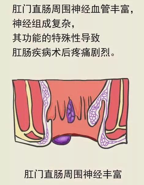 十个男人中九个有的屁股尴尬，你有吗？