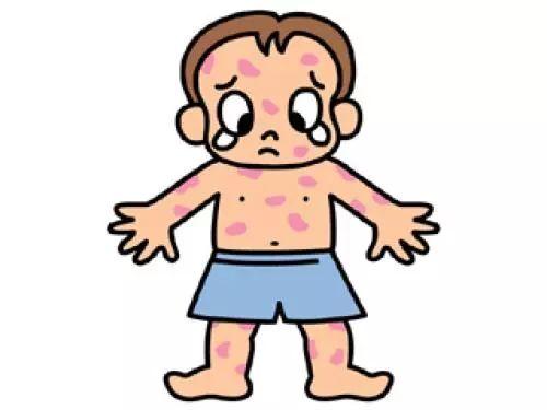 东莞一个班20多个学生请假？！近期这些疾病家长们要当心！