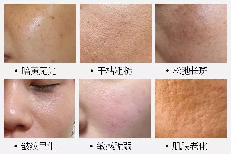 2岁的她靠“换脸”重回18，连李敏镐都为之痴迷，秘诀竟然是......"