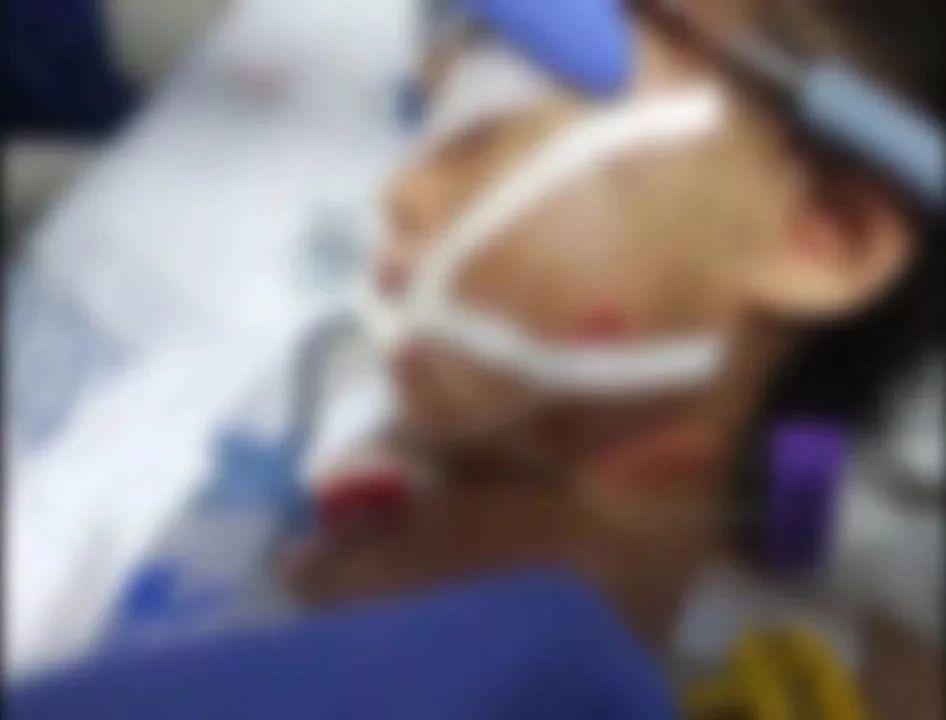 丧心病狂！1岁多女童被钢管戳胸、烟头烫肤，被摔死！