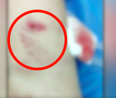 揪心！东莞一3岁男童被疯狗撕咬15秒！监控视频记录了下来！