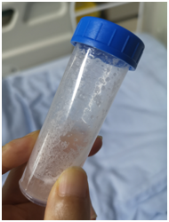 东莞一岁女童误把灯油当茶喝，进了ICU······