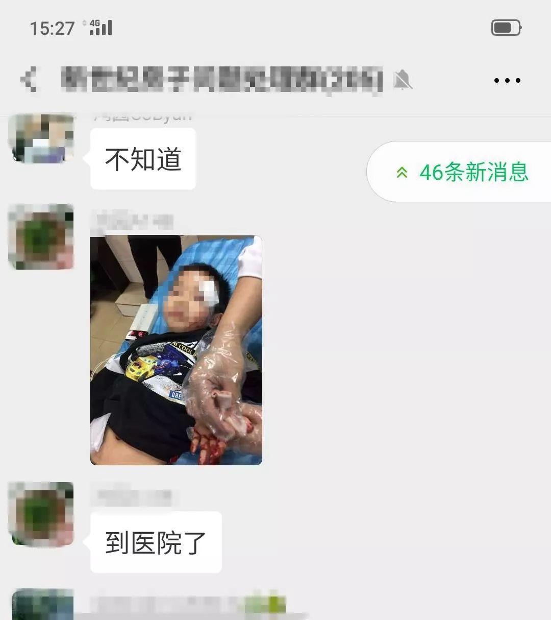 东莞又一孩子从二楼跌下，结果........