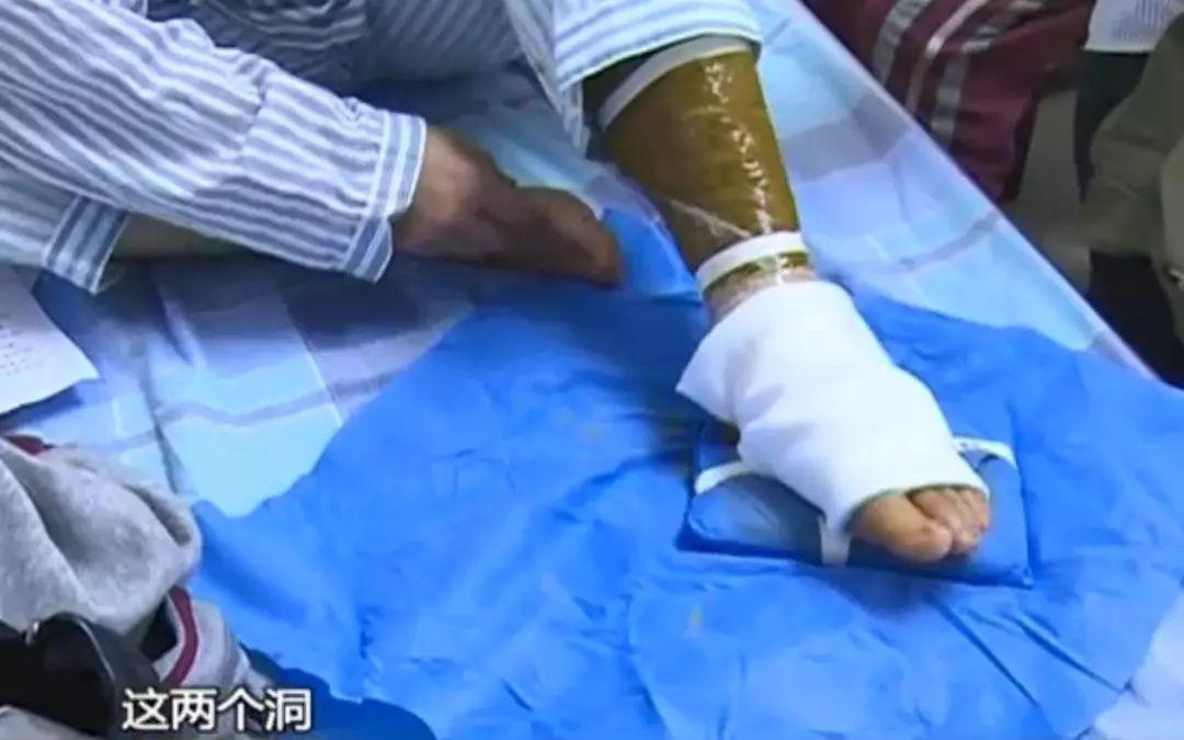 可怕！东莞多个小区公园有毒蛇出没！这7个镇街的街坊要小心！