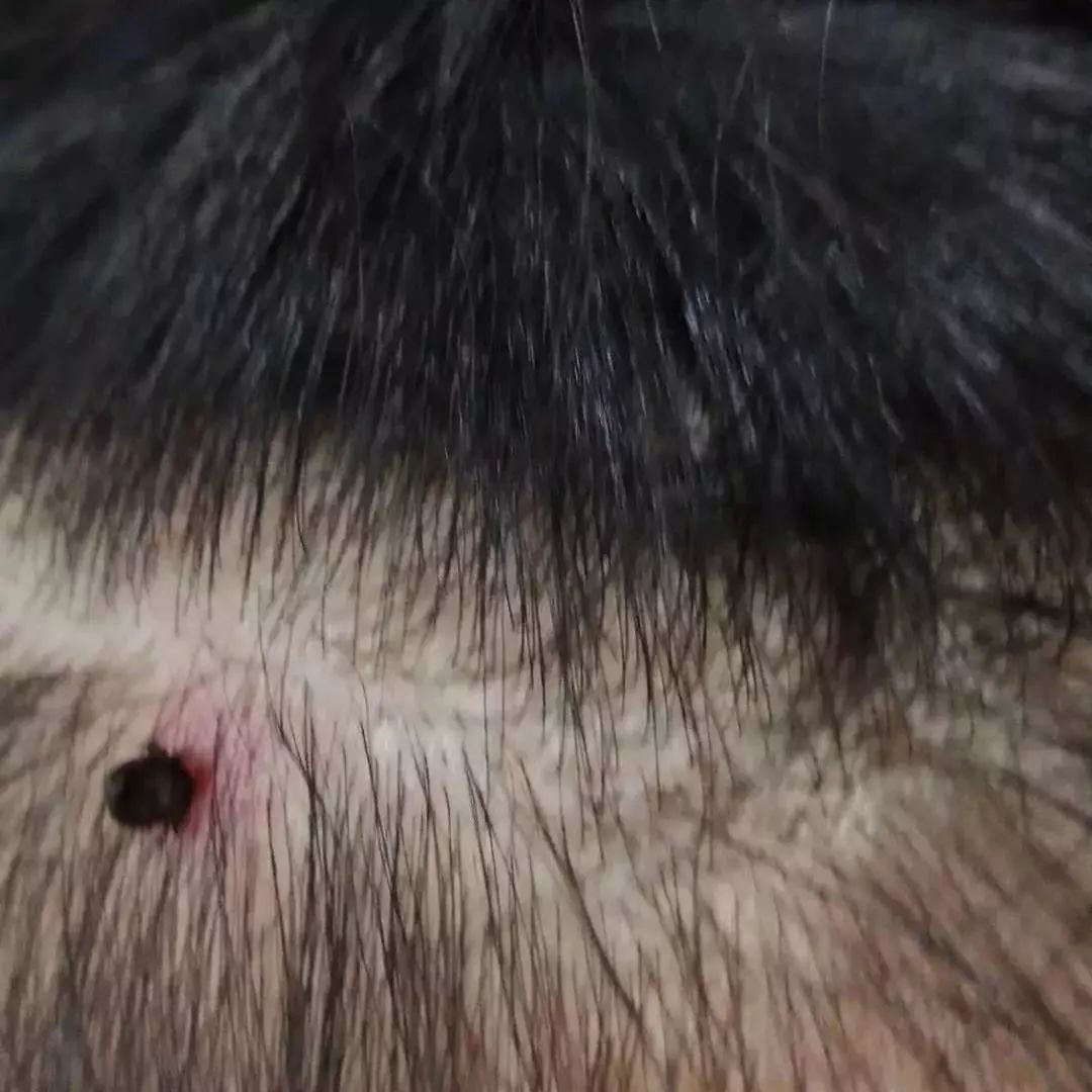 扩散！东莞人最近出门要小心这个东西！中招后严重可致死！