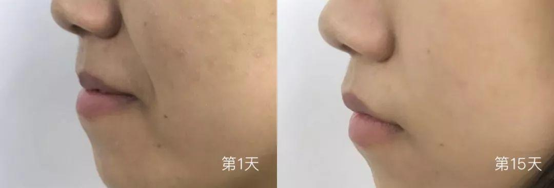 20！女人必看！告诉你1个小秘密！"