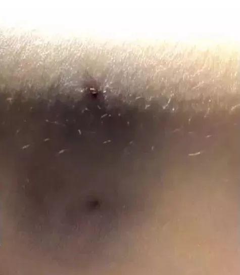 可怕！东莞一小区惊现多种毒蛇，多人被咬中毒！