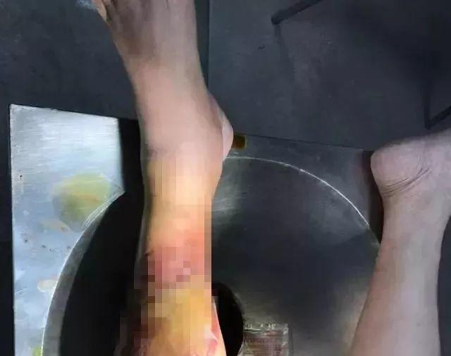 东莞人注意！路边见到这种小土堆，千万别碰！已有人中招！