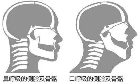 东莞的鼻炎患者有福了！10秒立马呼吸顺畅！鼻腔健康公益在身边！