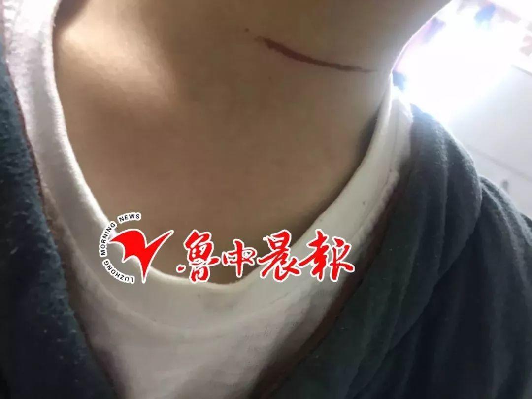 太吓人！一4岁女童被割颈！出门一定要当心！