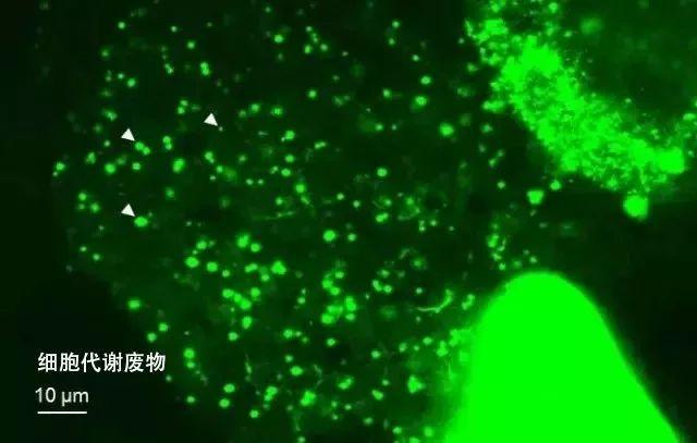 2岁的她靠“换脸”重回18，连李敏镐都为之痴迷，秘诀竟然是......"