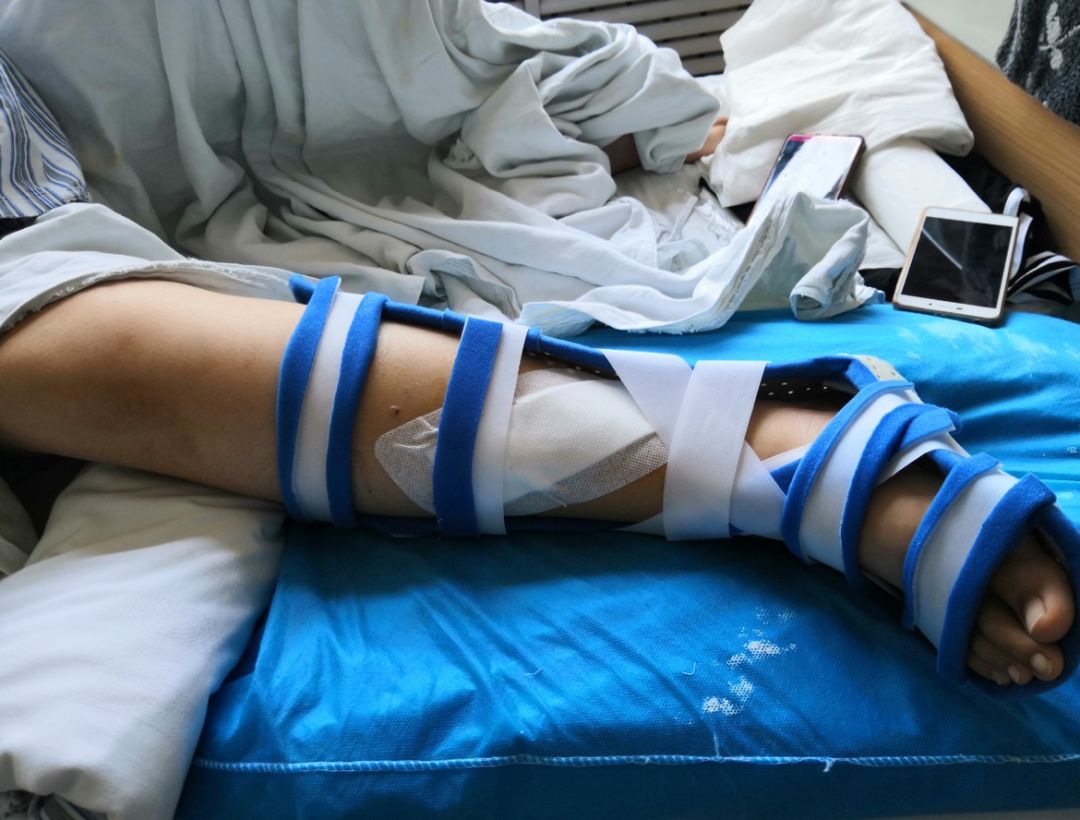 东莞人当心！网红蹦床又出事了！10岁女孩摔断腿！