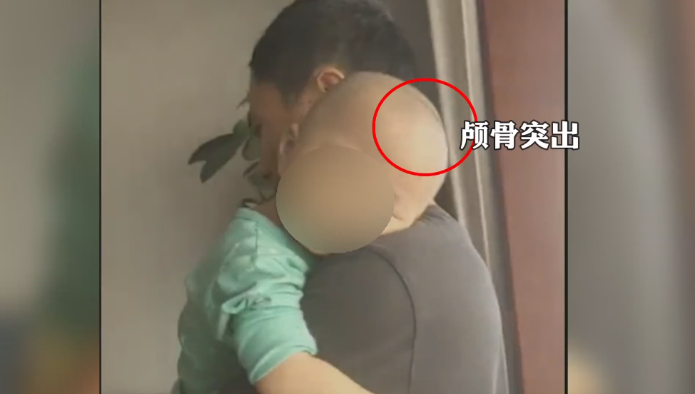 再现“大头娃娃”！多名幼儿食用同款“奶粉”后出事了，当地成立调查组