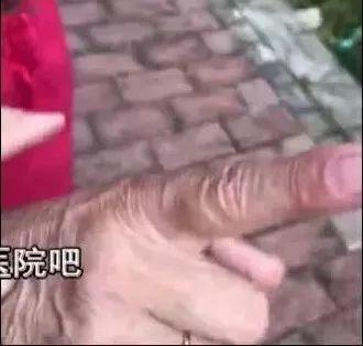 可怕！东莞一小区惊现多种毒蛇，多人被咬中毒！
