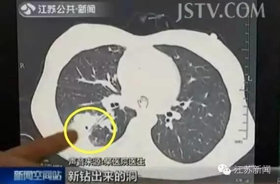 不要再吃这样的了，全是虫！快告诉家人！