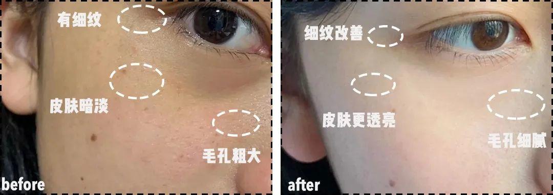 20!女人必看!告诉你1个小秘密!"