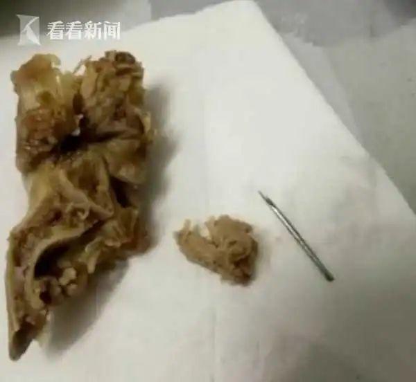 煲汤猪骨里吃出针头 屠宰场：属正常范围！