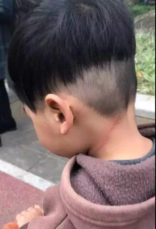 太吓人！一4岁女童被割颈！出门一定要当心！