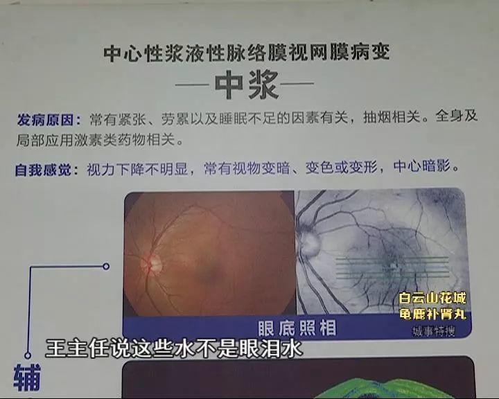 危险！东莞美女熬夜后眼睛“爆浆”！这3类人要特别注意……