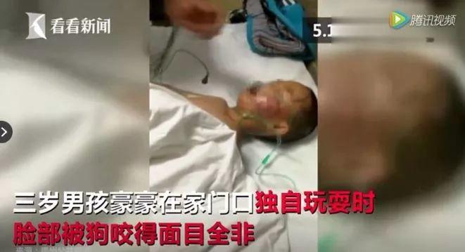 泰迪没吼也没咬，这位狗主人却赔了20万！只因这件事情没做好…