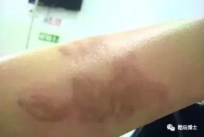 “我把两颗葡萄放进了微波炉，结果把房子炸没了”