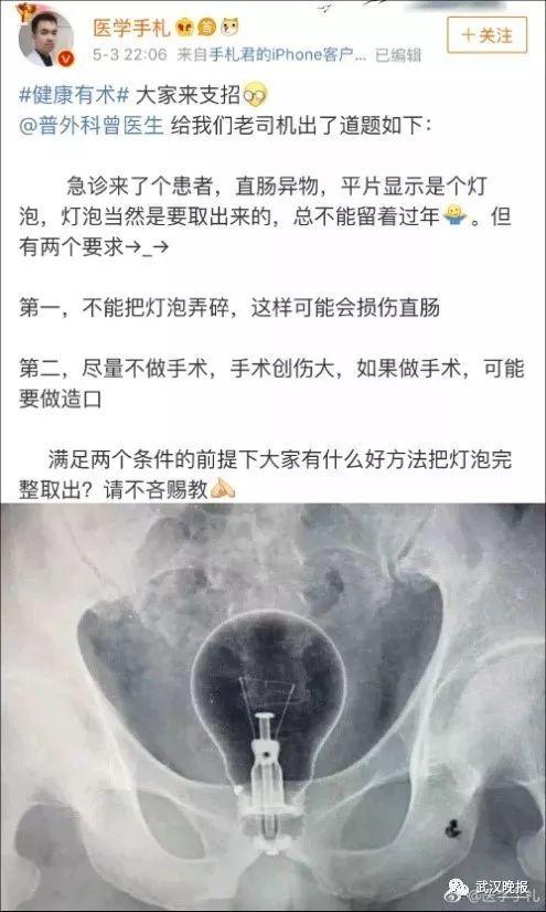 奇葩！东莞男子将18cm长的瓶子捅进肛门！竟是为了解决…