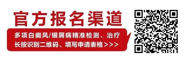 【公益征集】白癜风/银屑病（牛皮癣）患者100名，享受国家实验室项目精准治疗！