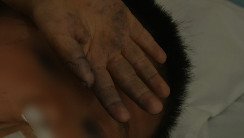 提醒！东莞这种“桑葚”不要买！有人吃完后，出事了……