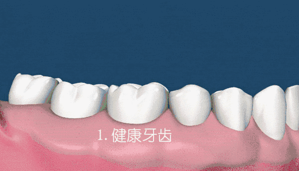 0后姑娘哭诉：我还这么年轻，牙齿怎么说没就没了......"