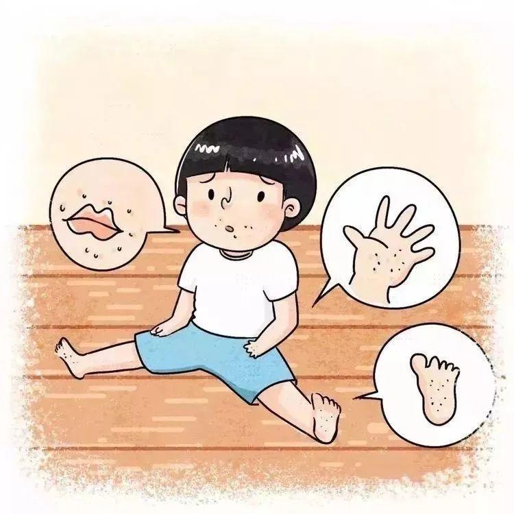 各位家长注意！东莞手足口病即将进入高发期！