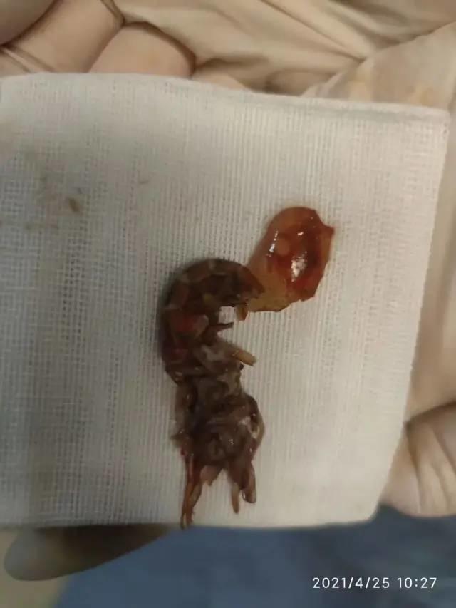 突发奇想! 14岁男孩竟把活的小龙虾, 塞进自己的......