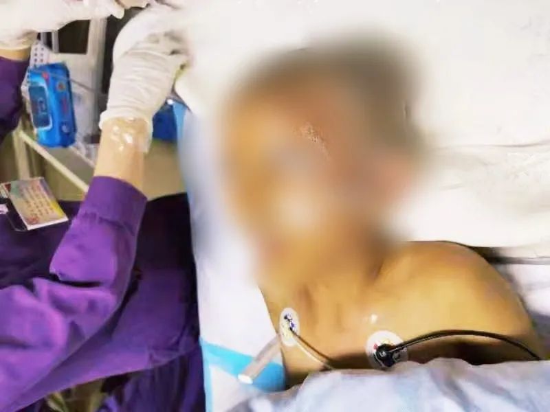 又是土方子！被妈妈用农药焗头驱虱，东莞11岁女孩进了ICU！