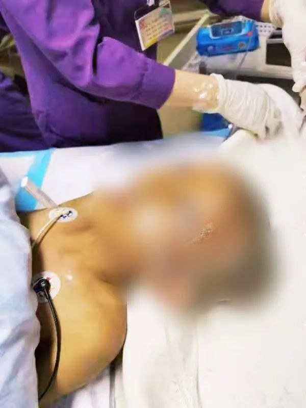 又是土方子！被妈妈用农药焗头驱虱，东莞11岁女孩进了ICU！