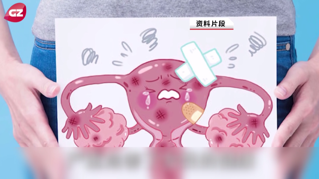 月经异常、不孕？注意了！你可能被这种“瘤”找上门了！
