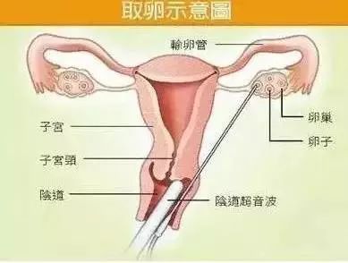 东莞女生小心！如果你的朋友圈有这种人，请立即删除！报警！
