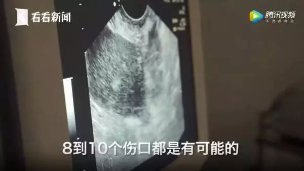 东莞女生小心！如果你的朋友圈有这种人，请立即删除！报警！