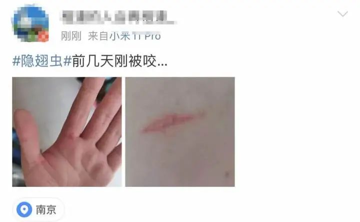 又是它！女子半夜关灯玩手机，差点致毁容！
