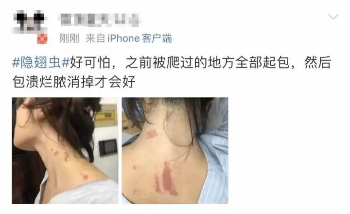 又是它！女子半夜关灯玩手机，差点致毁容！